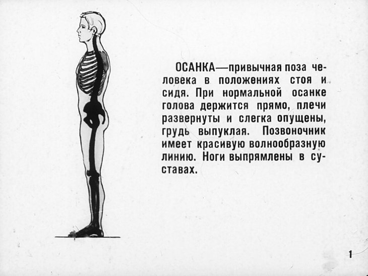Кадр 2 диафильма «Предупреждение и исправление нарушений осанки»