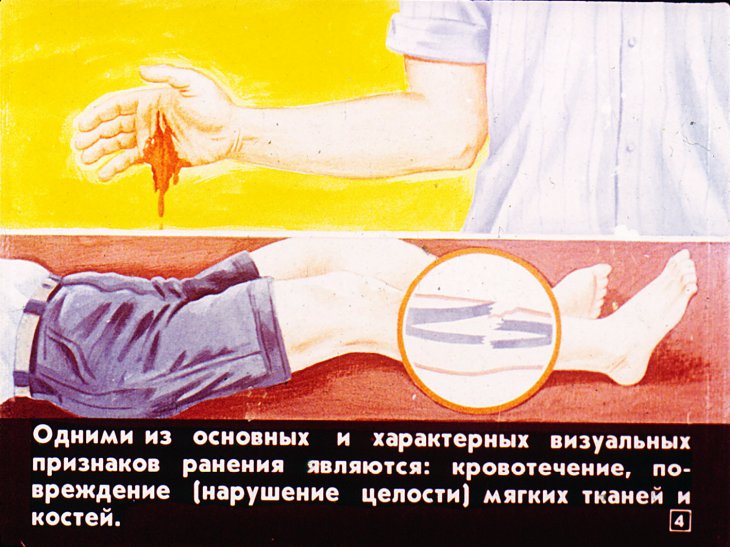 Кадр 4 диафильма «Оказание первой медицинской помощи пострадавшим»